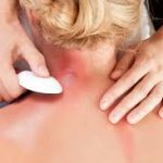 Questions to Ask Before Starting Acupuncture for Fertility Treatment