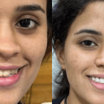 Cosmetic Dentistry In Andheri